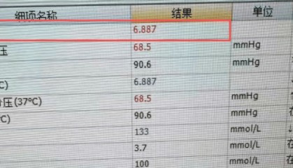 深圳27岁小伙一天没来上班，同事找上门后吓坏了！眼前一幕触目惊心……