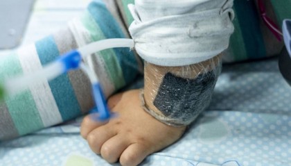 可瞬间产生近100℃高温!合肥医生发出提醒