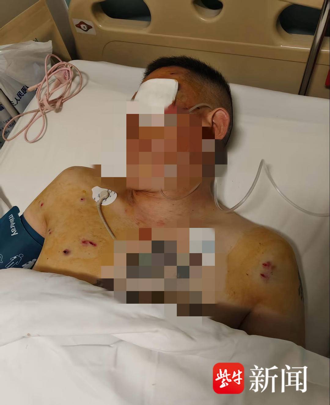 紫牛头条|男子取款170万在银行门口遭抢劫致重伤,当事人认为银行保安未帮忙应担责