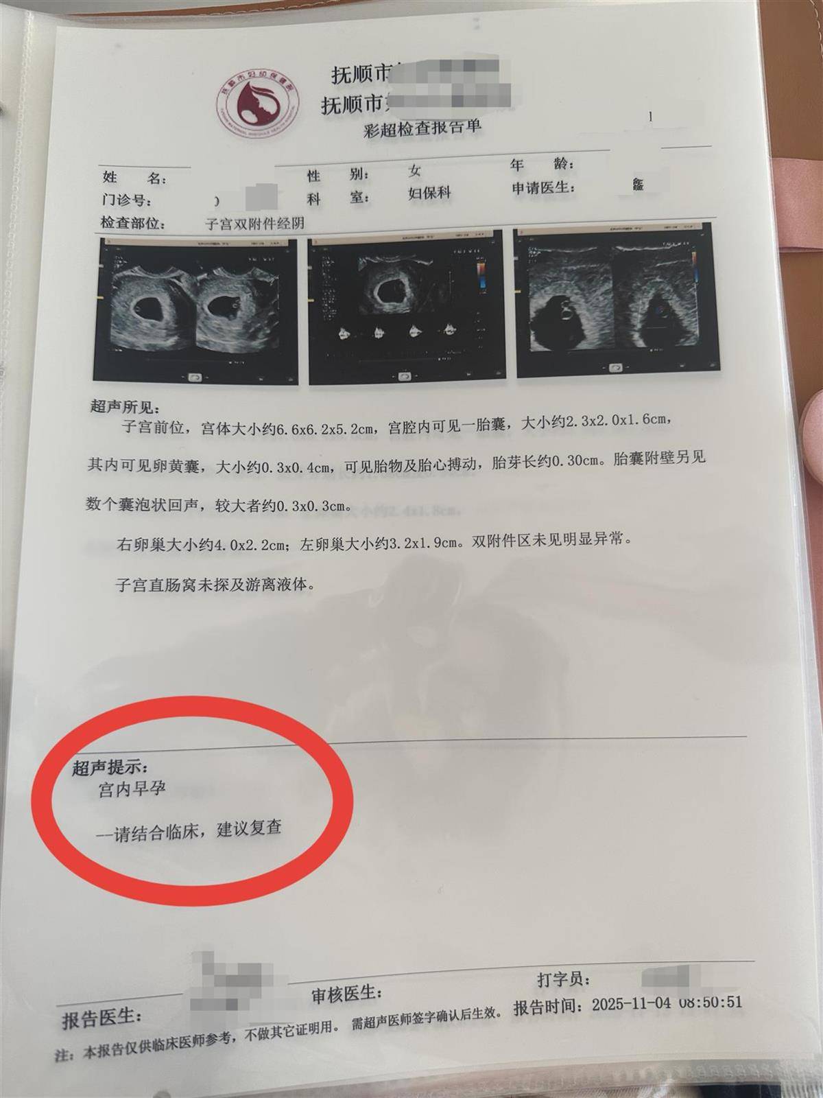 辽宁一孕妇两个月内从一胎变四胞胎,每次产检发现多出一胎,医生:系同卵四胞胎,概率1300万至1500万分之一