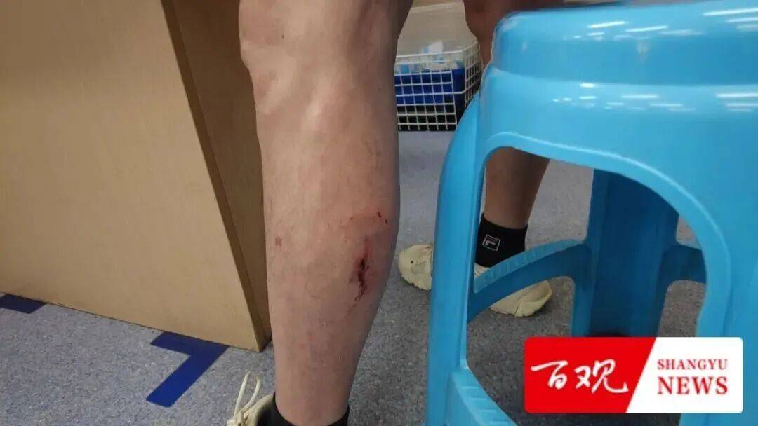 致死率近乎100％！杭州人注意，已进入全年高发时段